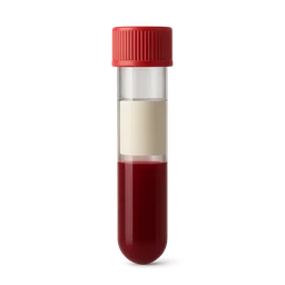 High Albumin/Globulin Ratio