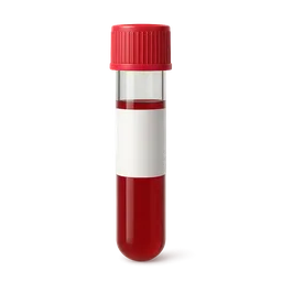 High Alkaline Phosphatase (ALP)