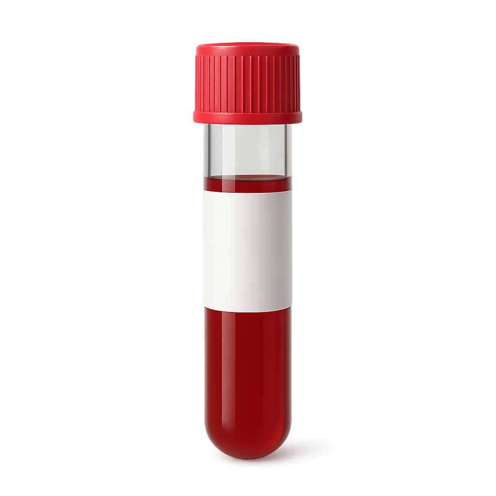 High Alkaline Phosphatase (ALP)