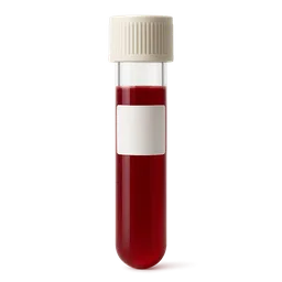 Biotin Lab Interference