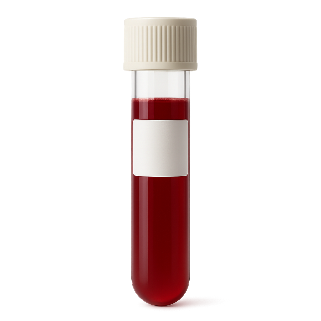 Biotin Lab Interference