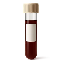 High BUN and High Creatinine (Both Elevated)