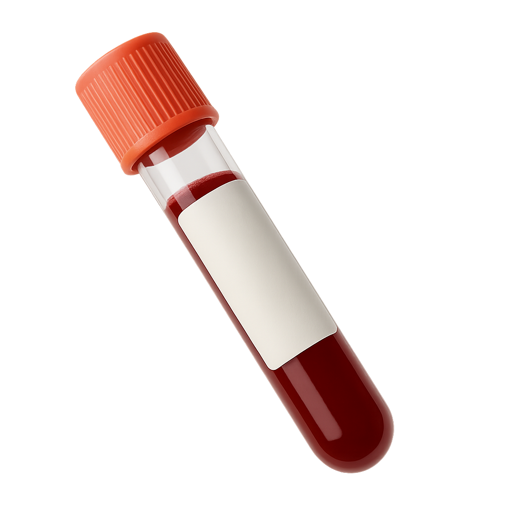 High Eosinophils
