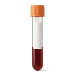 Low Eosinophils (Absolute)