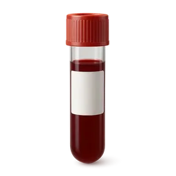 Fructosamine