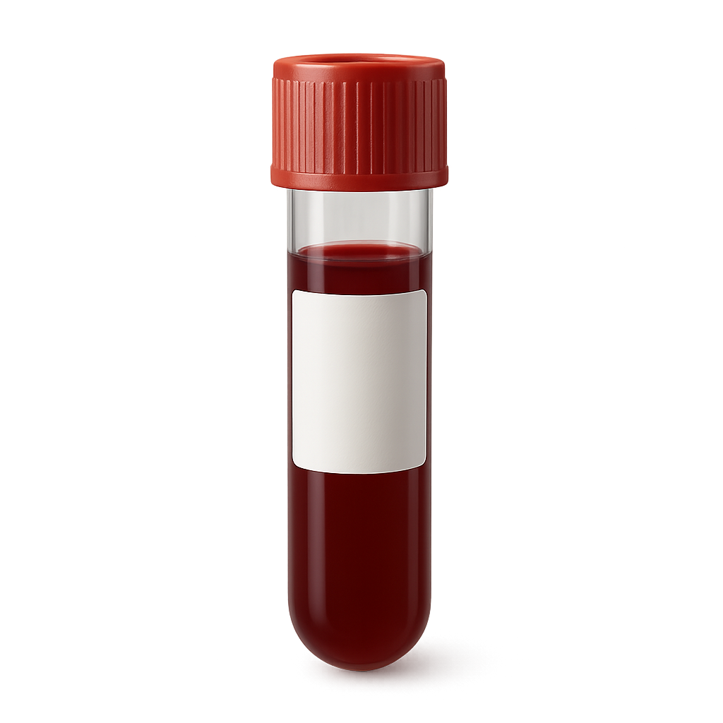 Fructosamine