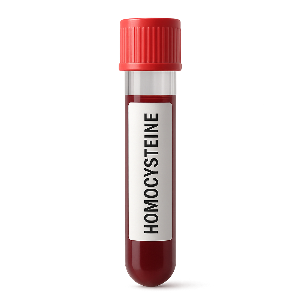 Homocysteine