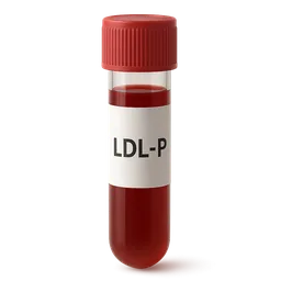 LDL Particle Number (LDL-P)