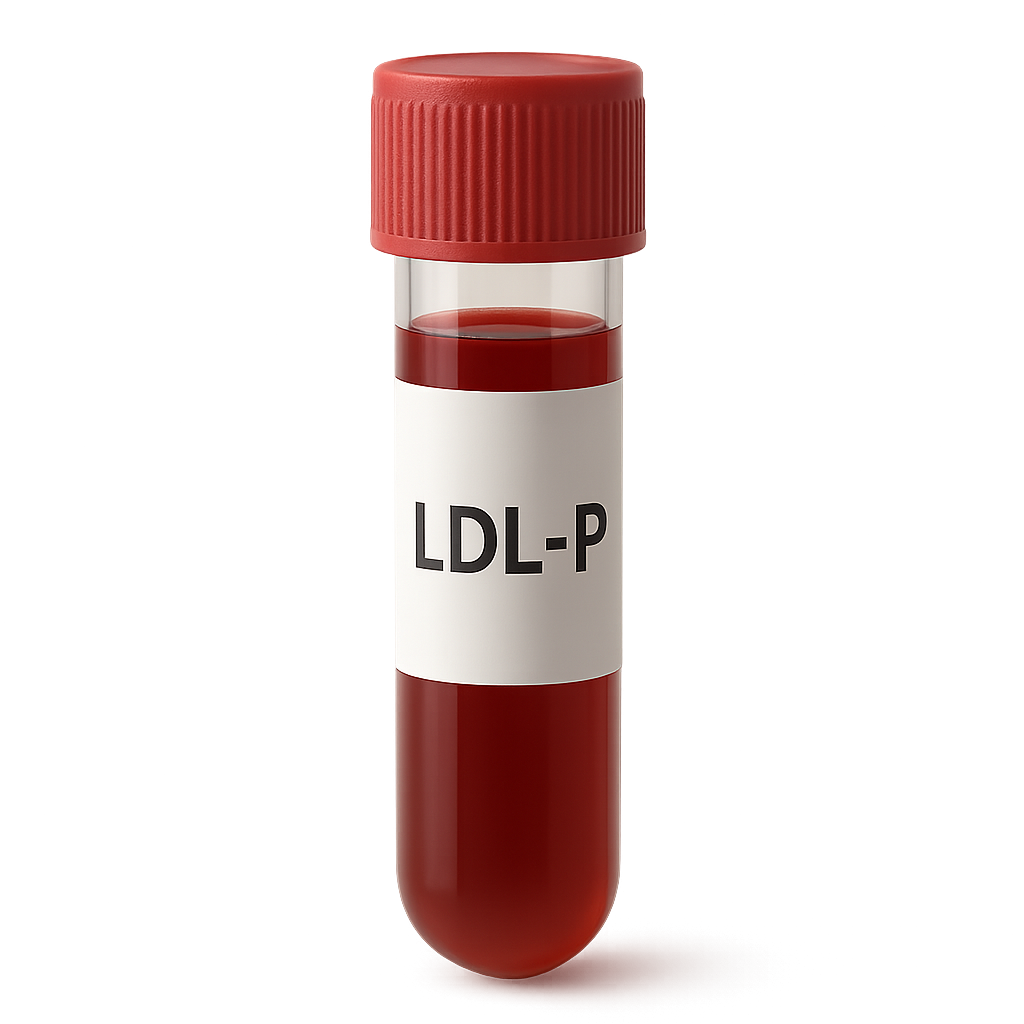 LDL Particle Number (LDL-P)