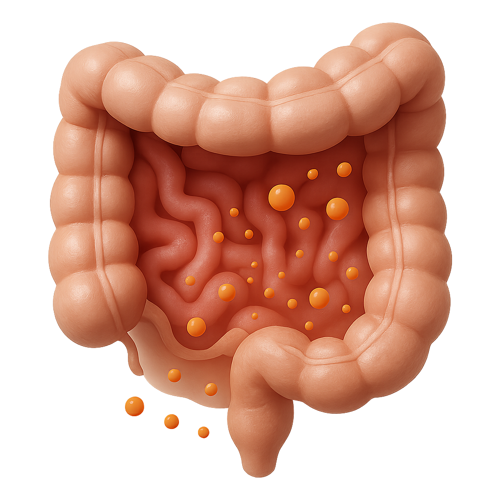 Increased Intestinal Permeability ('Leaky Gut')