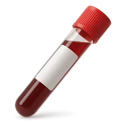 Absolute Lymphocyte Count