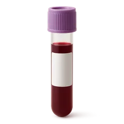 High Lymphocytes (Absolute)