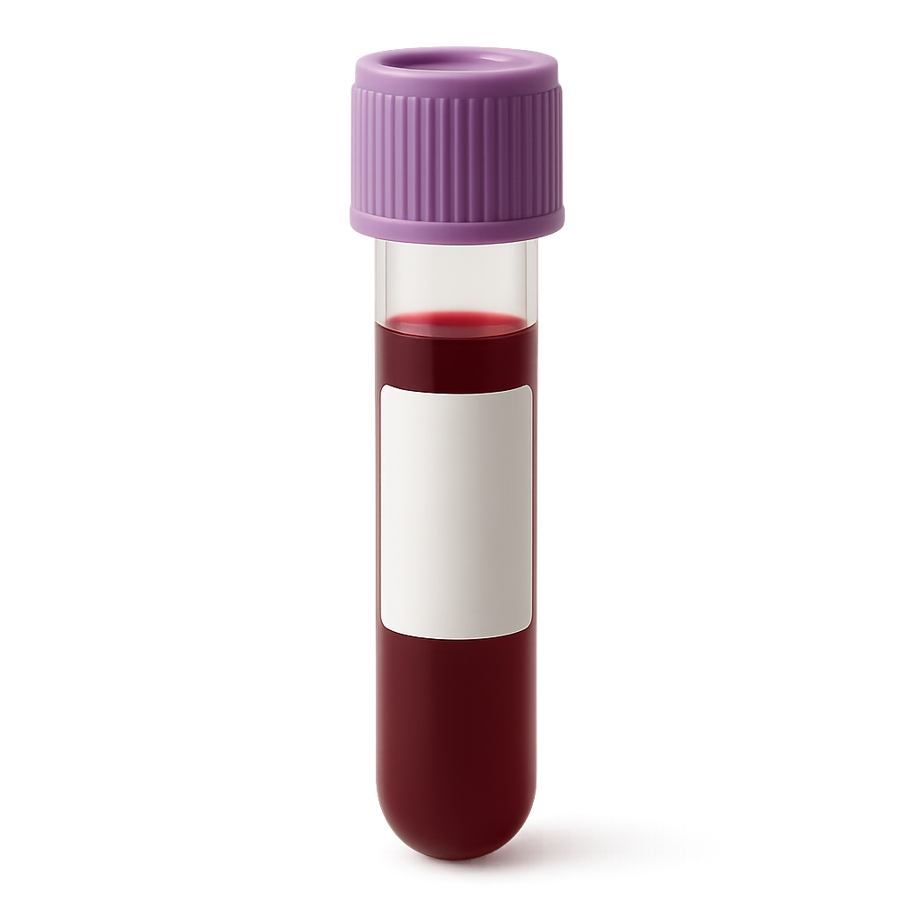 High Lymphocytes