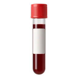High MCHC (Mean Corpuscular Hemoglobin Concentration)
