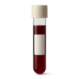 Absolute Monocyte Count