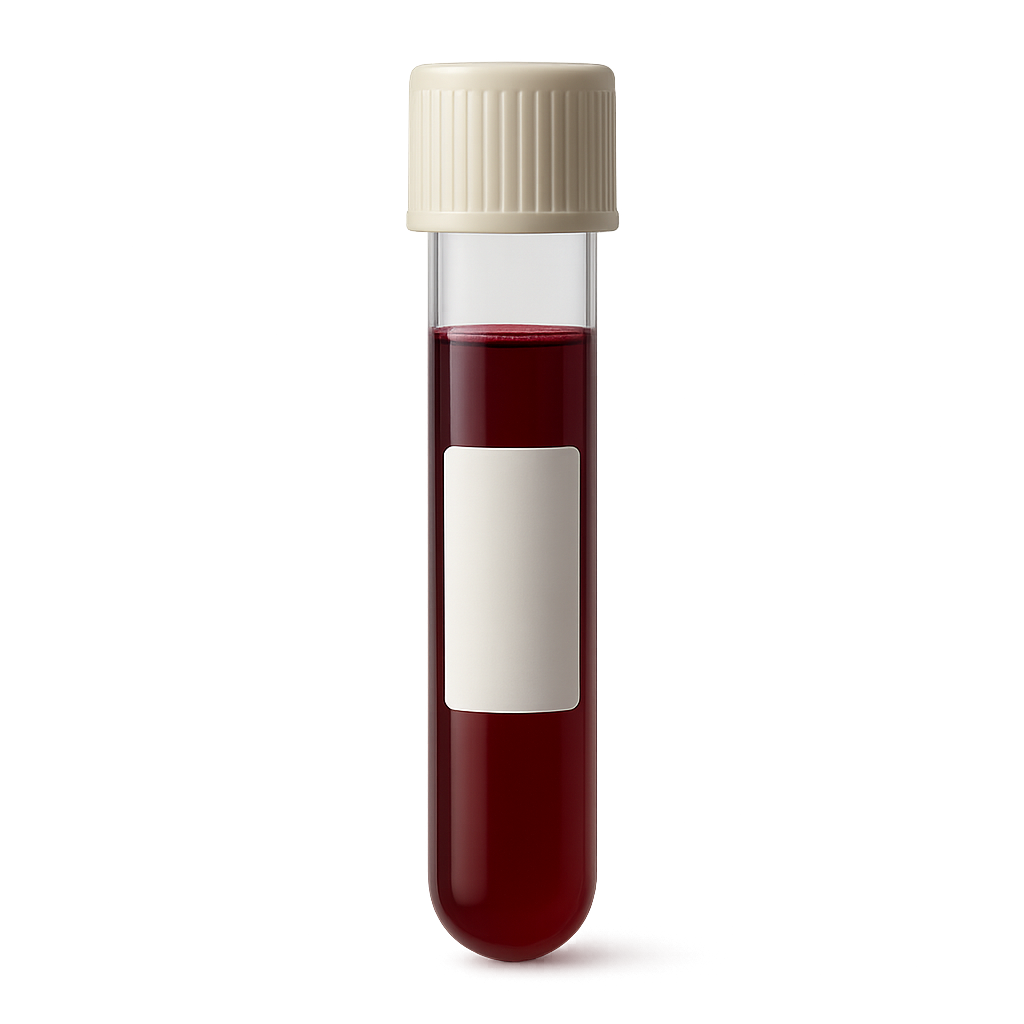 Absolute Monocyte Count