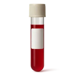 High Monocytes (Absolute)