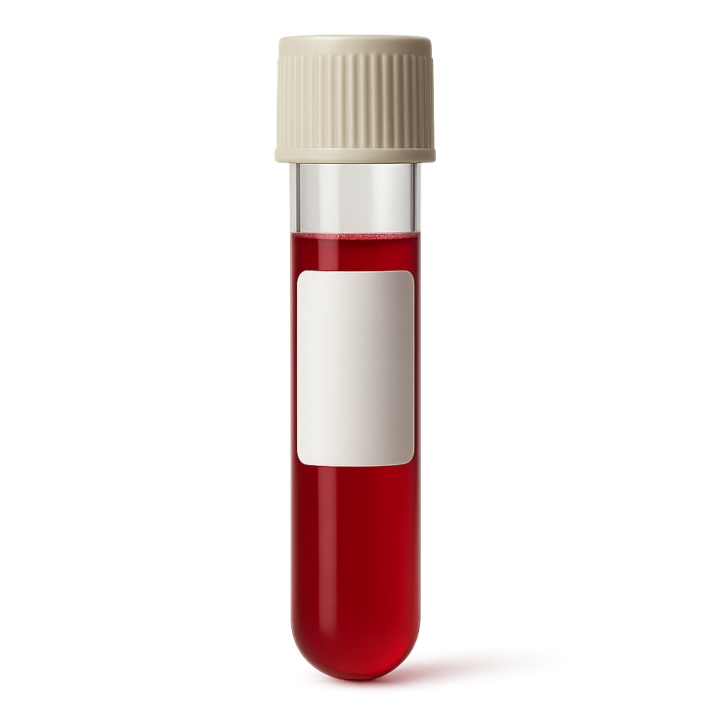 High Monocytes (Absolute)