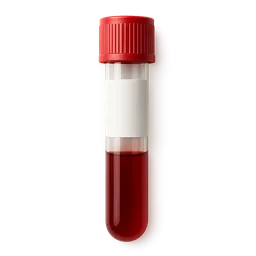 Low Monocytes (Absolute)
