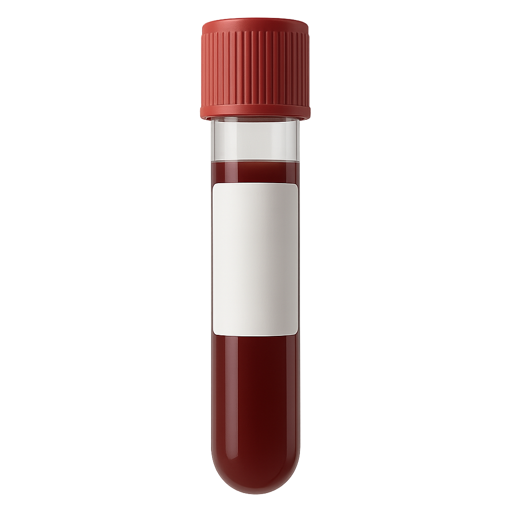 MPV (Mean Platelet Volume) Test