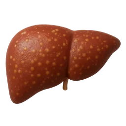 Non-Alcoholic Fatty Liver Disease (NAFLD)