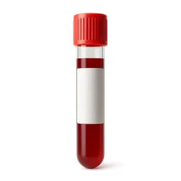 High RDW (Red Cell Distribution Width)