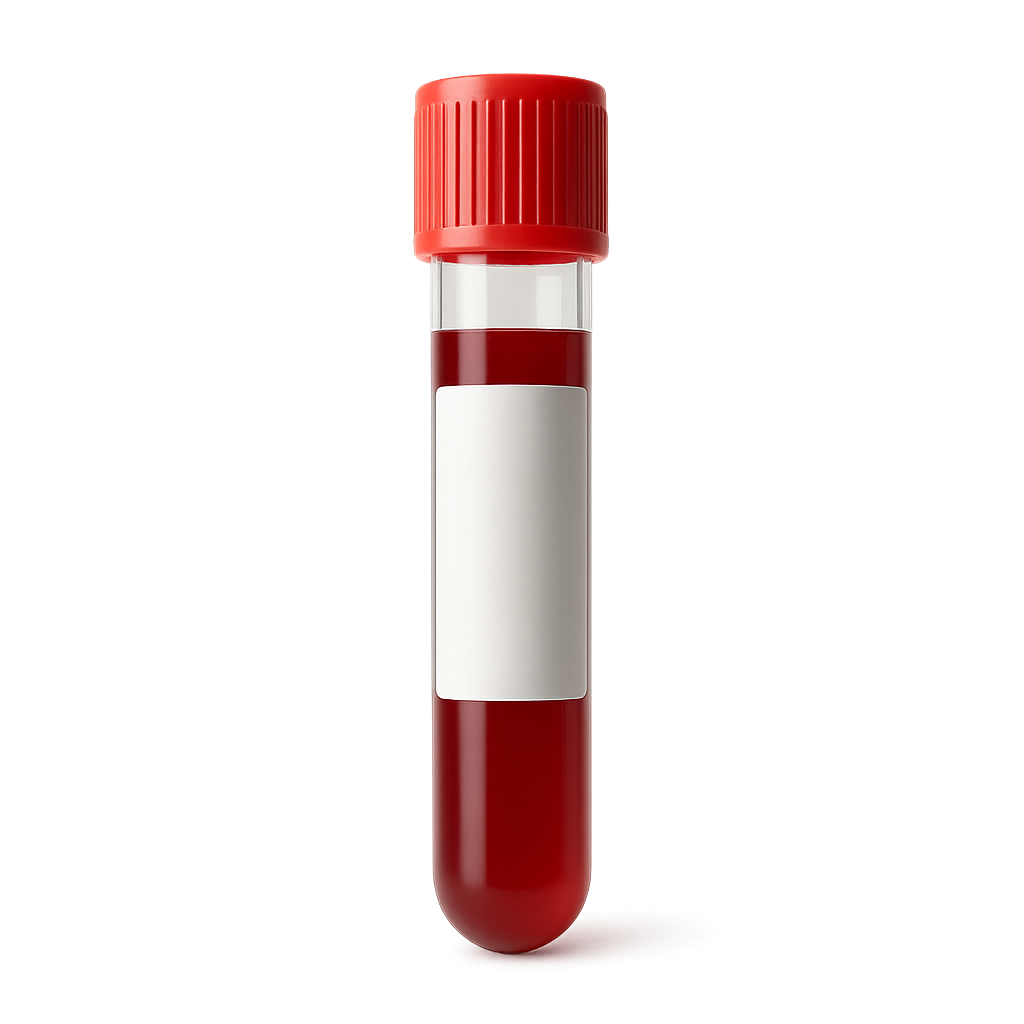 High RDW (Red Cell Distribution Width)