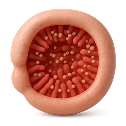 SIBO (Small Intestinal Bacterial Overgrowth)