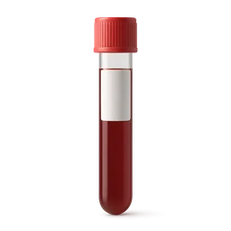 High Triglycerides