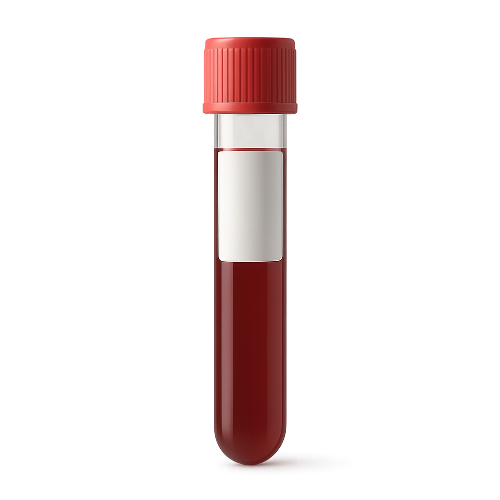 High Triglycerides