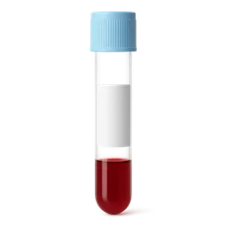 Low Unsaturated Iron-Binding Capacity (UIBC)