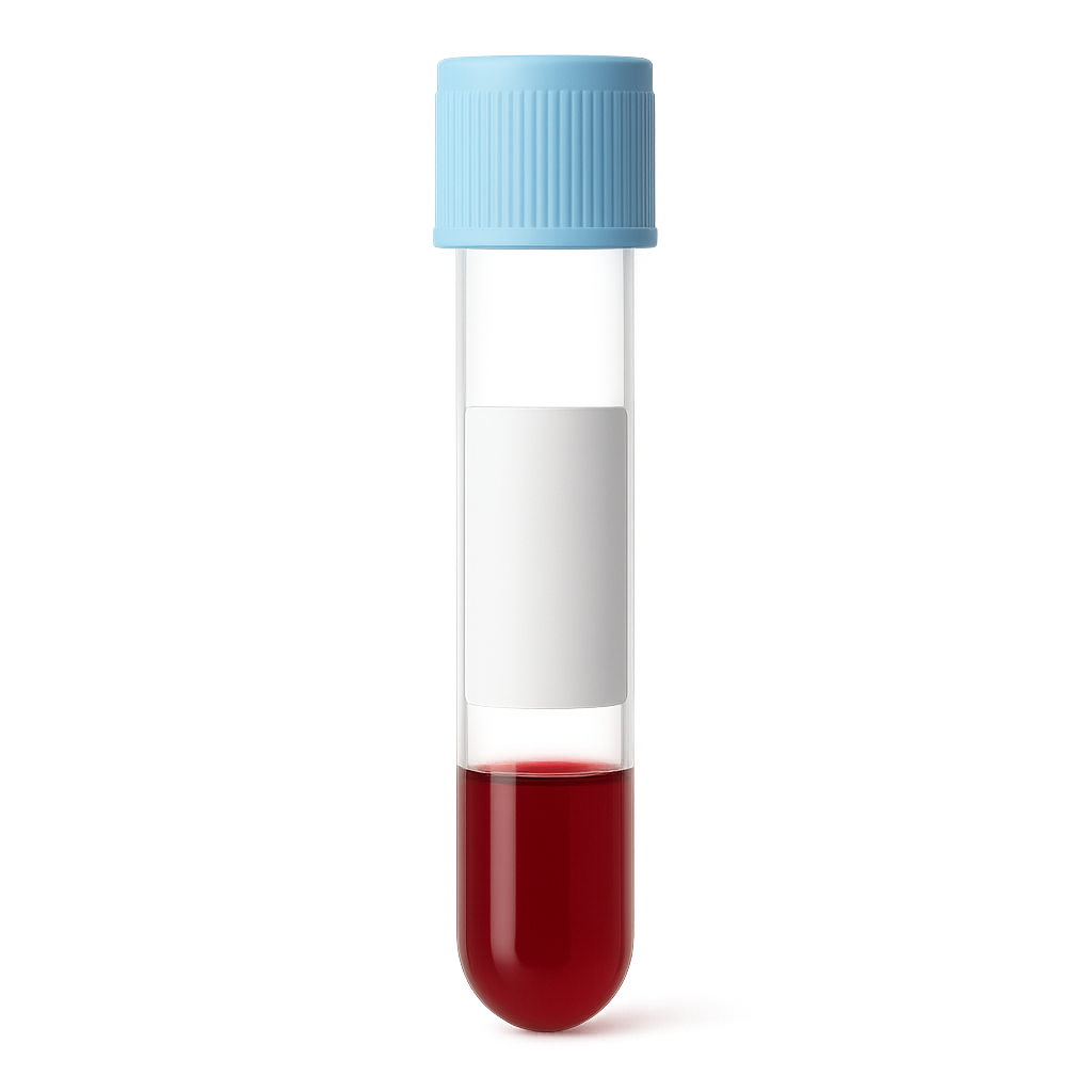 Low Unsaturated Iron-Binding Capacity